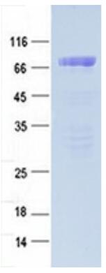 Coomassie blue staining of purified AZIN1 protein.